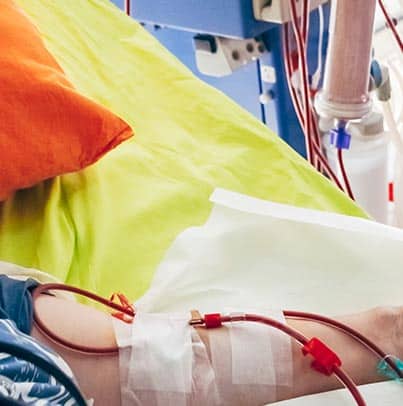 Les plaies chroniques en dialyse
